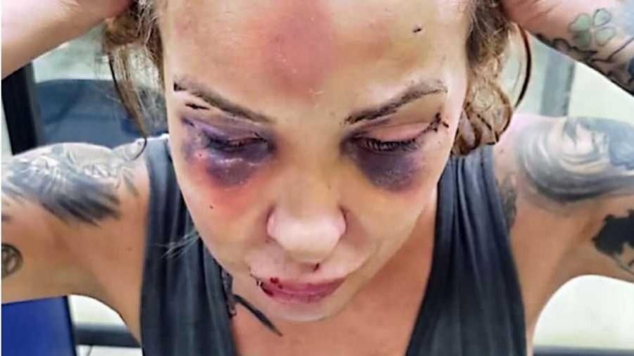 Mulher é agredida com soco inglês e cassetete por 3 dias e namorado é preso