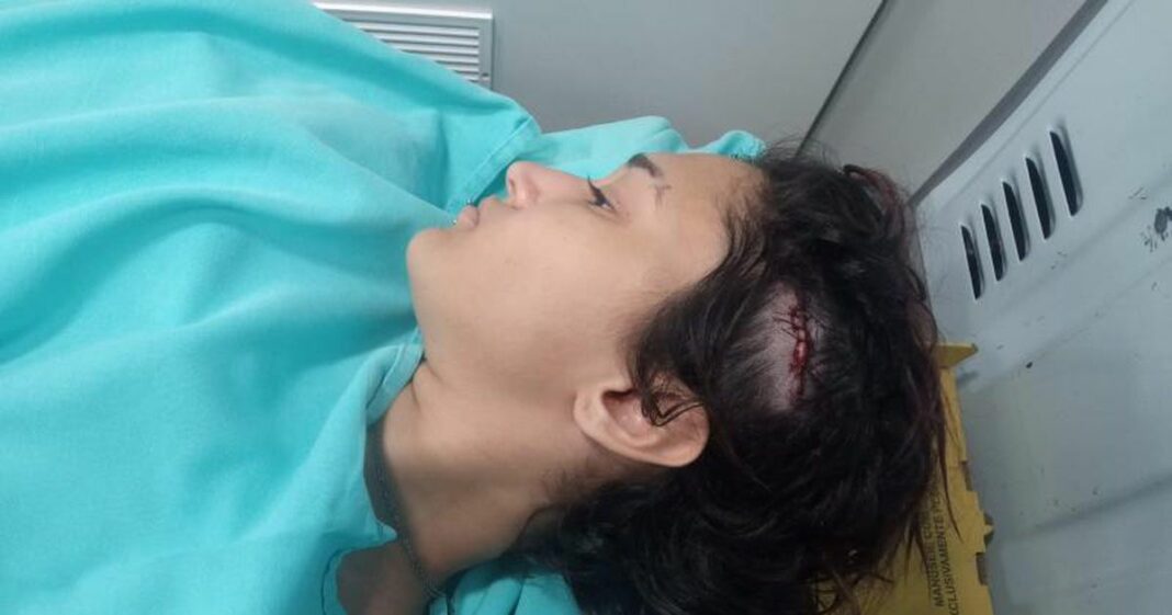 Jovem é agredida na cabeça com madeira após crítica a Bolsonaro em bar: ‘Vai apanhar que nem homem’