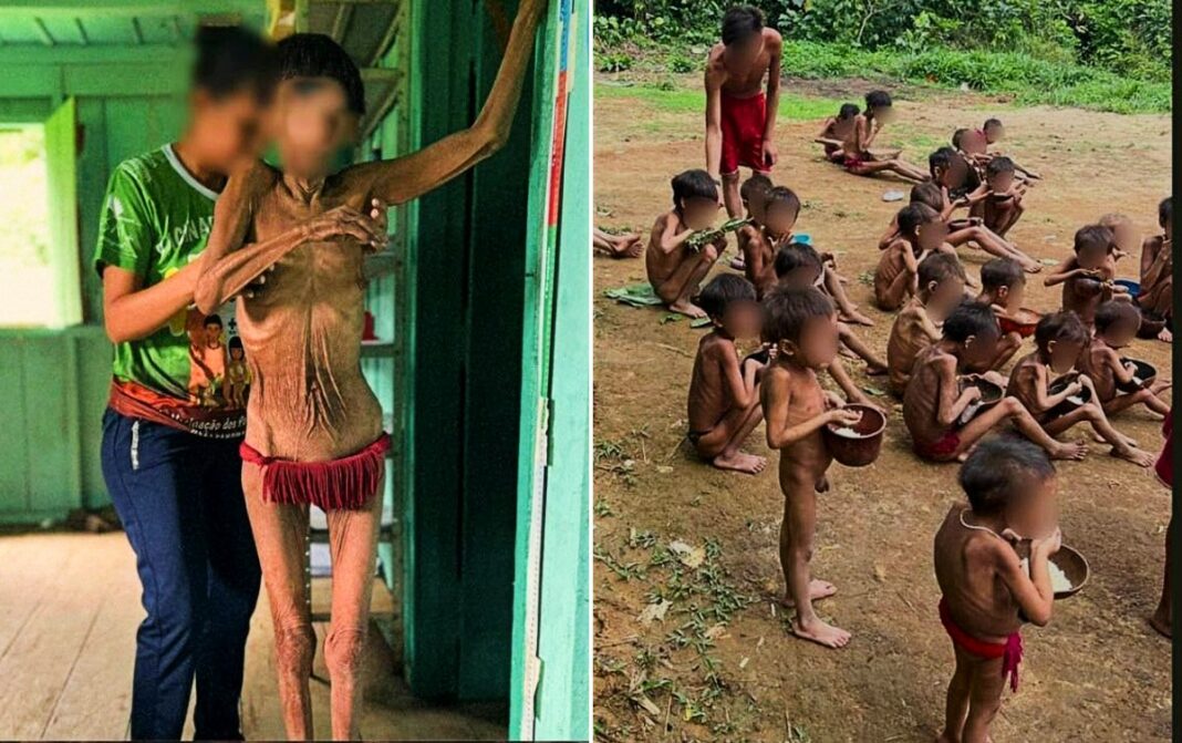 MPF vai apurar responsabilidade do Estado na crise dos yanomami