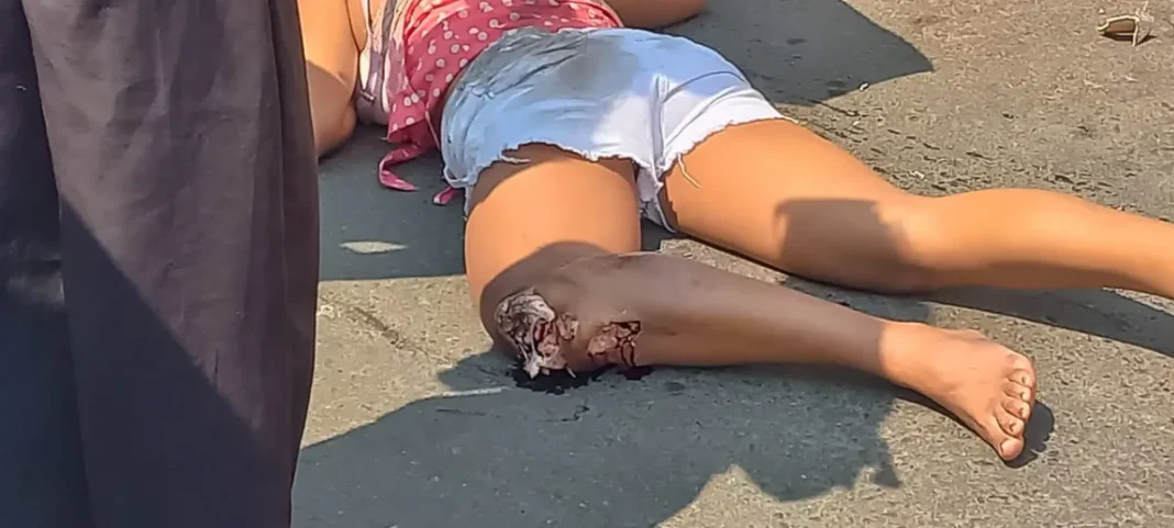 Mulher sofre acidente com fratura exposta no centro de Vilhena