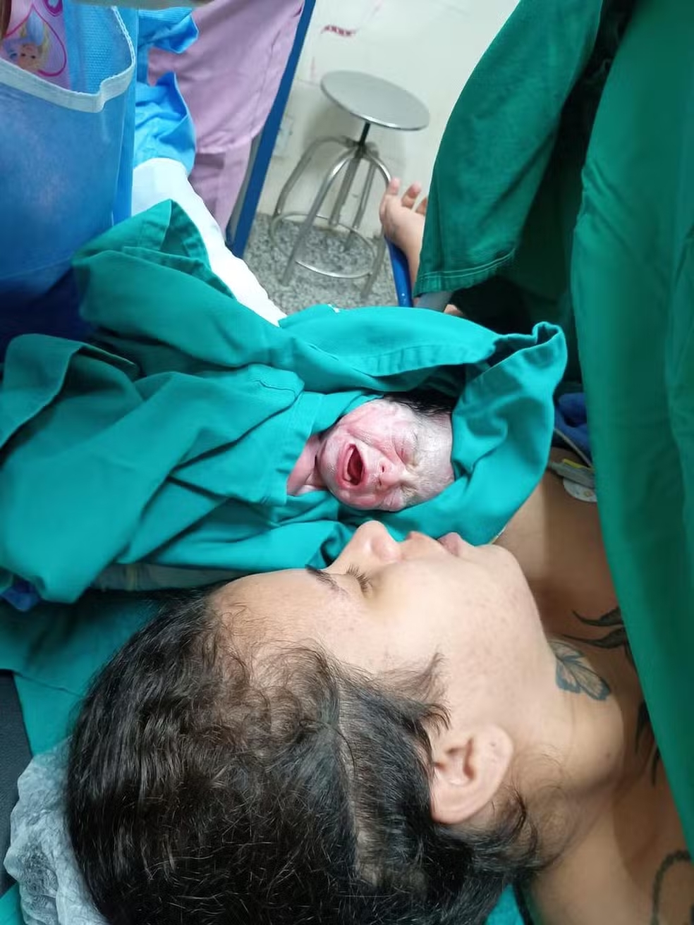 Parto raro de trigêmeas univitelinas é realizado na nova maternidade do Hospital de Base, em Porto Velho