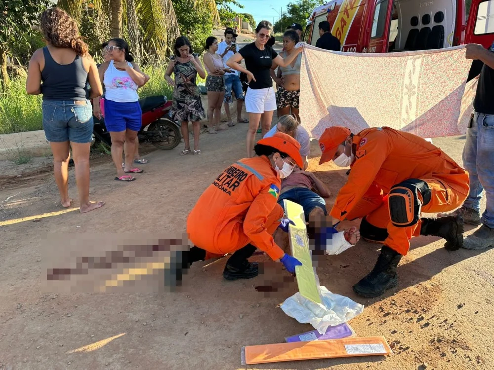 Motociclista sofre fratura exposta em colisão