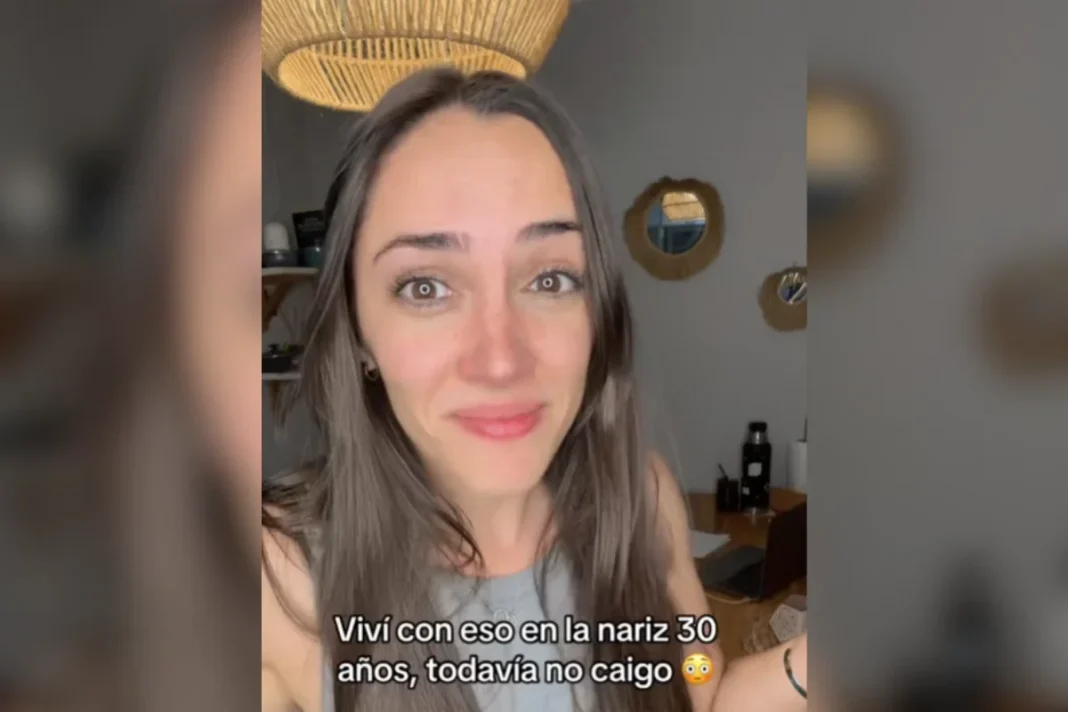 Mulher descobre bola de fita adesiva presa dentro do nariz há 30 anos