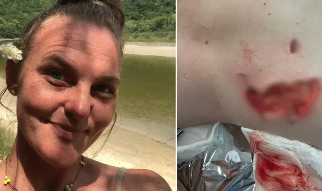 Mulher é atacada por capivara e tem parte da nádega arrancada