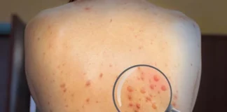 Homem com sinais do novo vírus é visto fazendo compras em RO