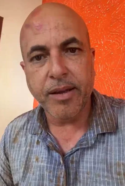 Deputado de RO sofre acidente e passa bem