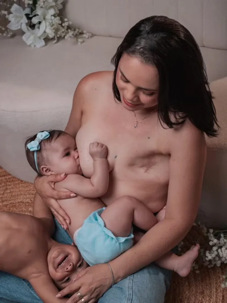 Após mastectomia, mãe de RO faz ensaio e celebra superação