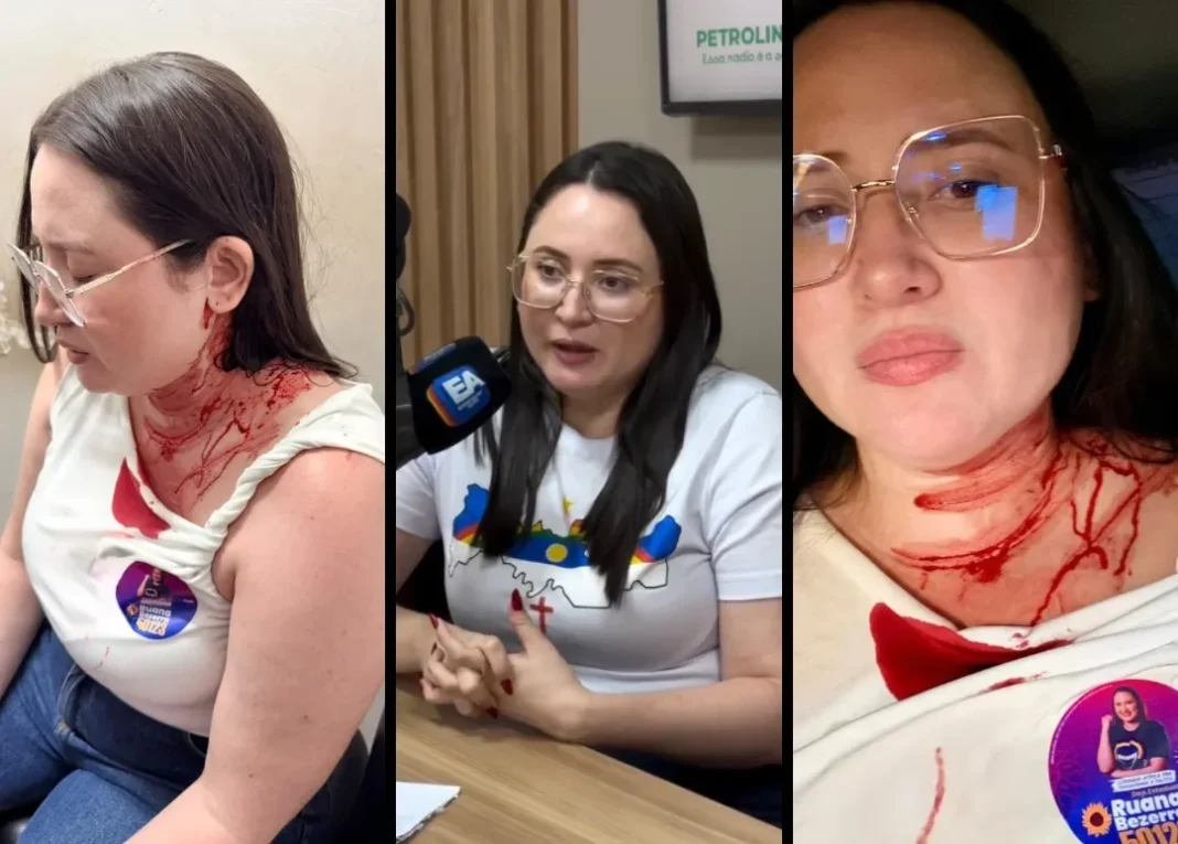 Candidata do PSOL é atacada com pedrada na cabeça